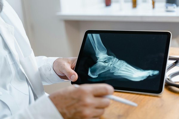Matériel orthopédique en ligne : votre confort à portée de main